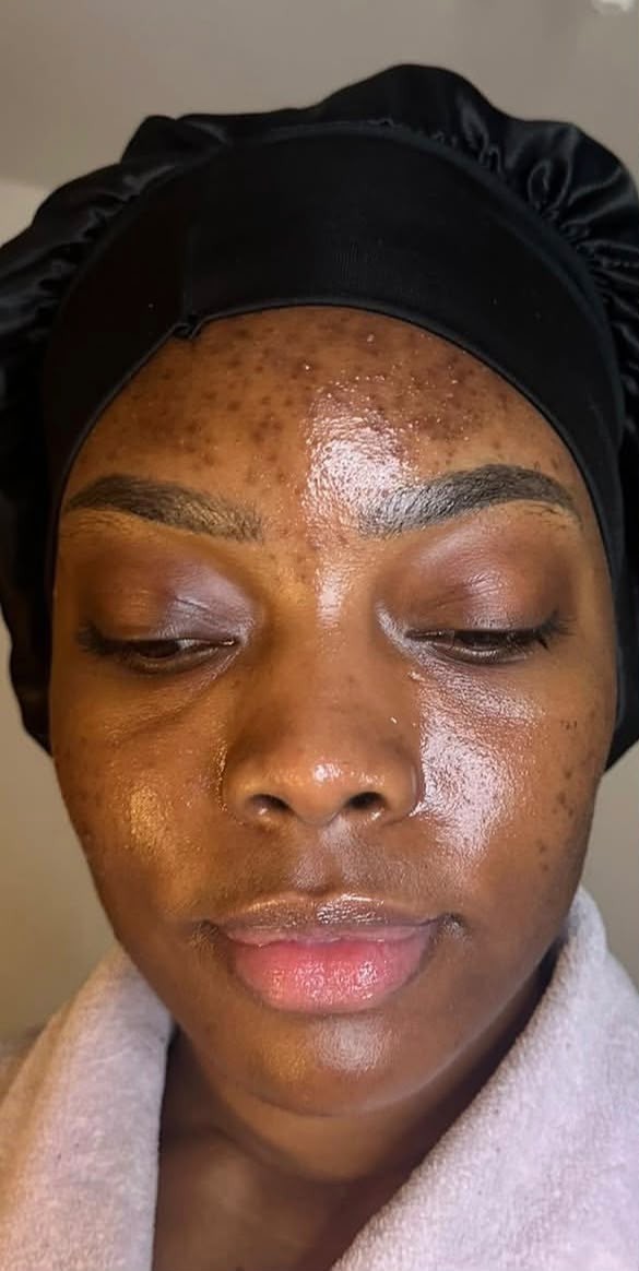Client 3, front view — before treatment